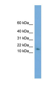 HRSP12 antibody LS-C116445 Western blot of Jurkat lysate.