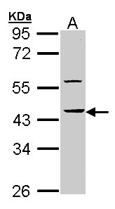 Sample (30 ug of whole cell lysate). A: Molt-4 . 10% SDS PAGE. HS1BP3 antibody diluted at 1:10000.