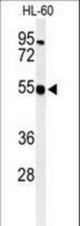 Western blot of HS2ST1 Antibody in HL-60 cell line lysates (35 ug/lane). HS2ST1 (arrow) was detected using the purified antibody.