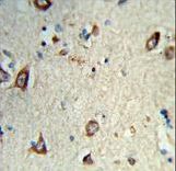 Formalin-fixed and paraffin-embedded human brain tissue reacted with HS3ST2 Antibody , which was peroxidase-conjugated to the secondary antibody, followed by DAB staining. This data demonstrates the use of this antibody for immunohistochemistry; clinical relevance has not been evaluated.
