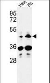 Western blot of HS3ST2 Antibody in HeLa, 293 cell line lysates (35 ug/lane). HS3ST2 (arrow) was detected using the purified antibody.