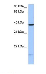 MCF7 cell lysate. Antibody concentration: 0.5 ug/ml. Gel concentration: 12%.