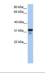 721_B cell lysate. Antibody concentration: 1.0 ug/ml. Gel concentration: 12%.