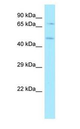 HS6ST1 antibody Western Blot of MCF7.