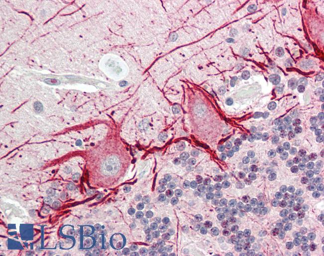 Human Brain, Cerebellum: Formalin-Fixed, Paraffin-Embedded (FFPE)