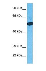 Western blot of H6ST3 Antibody with human Fetal Lung lysate.