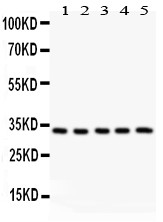 HSD11B1 antibody Western blot. All lanes: All lanes: Anti HSD11B1 at 0.5 ug/ml. Lane 1: Rat Liver Tissue Lysate at 50 ug. Lane 2: Rat Testis Tissue Lysate at 50 ug. Lane 3: SMMC Whole Cell Lysate at 40 ug. Lane 4: RAJI Whole Cell Lysate at 40 ug. Lane 5: SW620 Whole Cell Lysate at 40 ug. Predicted band size: 32 kD. Observed band size: 32 kD.