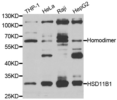 Western blot analysis of extracts of various cell lines, using HSD11B1 antibody.
