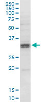 HSD11B1 monoclonal antibody (M02A), clone 2C10. Western Blot analysis of HSD11B1 expression in MCF-7.