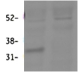 HSD11B1 antibody (0.3 ug/ml) staining of Mouse Lung lysate (60 ug protein in RIPA buffer). First lane shows wild type and second lane shows knockout background. Primary incubation was overnight. Detected by fluorescence with Li-cor). Data obtained from Prof. K. Chapman and Zhenguang Zhang, Centre for Cardiovascular Sciences, Queens Medical Research Institute, Edinburgh, UK