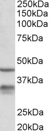 HSD11B1 antibody (0.3 ug/ml) staining of Mouse Lung lysate (35 ug protein in RIPA buffer). Primary incubation was 1 hour. Detected by chemiluminescence.