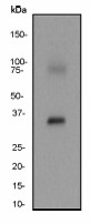 Western blot analysis on human placenta lysate using anti-HSD17B1 antibody (LS-C105251), dilution 1:500.