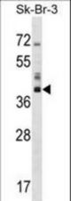 HSD17B1 Antibody western blot of SK-BR-3 cell line lysates (35 ug/lane). The HSD17B1 antibody detected the HSD17B1 protein (arrow).