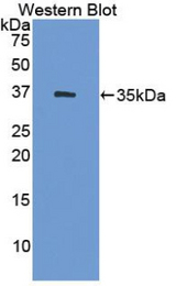 Western blot of recombinant HSD17 / HSD17B1.