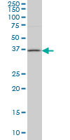 HSD17B1 monoclonal antibody (M03), clone 2E5 Western blot of HSD17B1 expression in Jurkat.