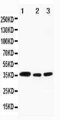WB of HSD17 / HSD17B1 antibody. All lanes: Anti-HSD17B1 at 0.5ug/ml. Lane 1: Rat Kidney Tissue Lysate at 40ug. Lane 2: Mouse Ovary Tissue Lysate at 40ug. Lane 3: Mouse Ovary Tissue Lysate at 40ug. Predicted bind size: 35KD. Observed bind size: 38KD.