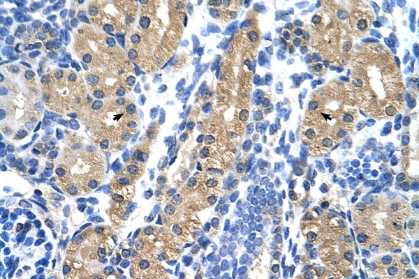 HSD17B1 antibody LS-C30533 IHC of formalin-fixed, paraffin-embedded human Kidney. Positive label: Epithelial cells of renal tubule indicated with arrows. Antibody concentration 4-8 ug/ml. Magnification 400X.