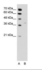 A: Marker, B: Jurkat Cell Lysate