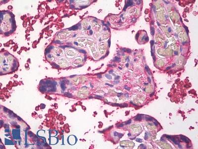 Anti-HSD17 / HSD17B1 antibody IHC of human placenta. Immunohistochemistry of formalin-fixed, paraffin-embedded tissue after heat-induced antigen retrieval. Antibody LS-B8091 dilution 1:50.