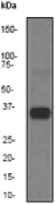 Western blot analysis on human placenta lysate using anti-HSD17B1 antibody, dilution 1:100000.