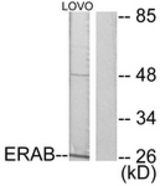 Western blot of extracts from LOVO cells, using ERAB Antibody. The lane on the right is treated with the synthesized peptide.