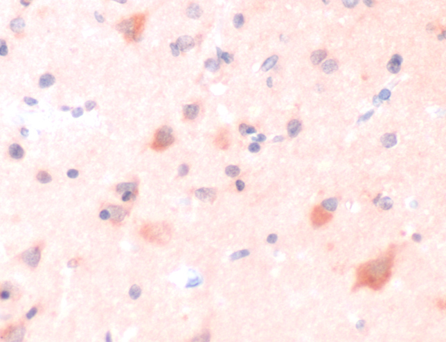 Immunohistochemistry of Human Alzheimer&#39;s Brain stained with anti-ERAB antibody