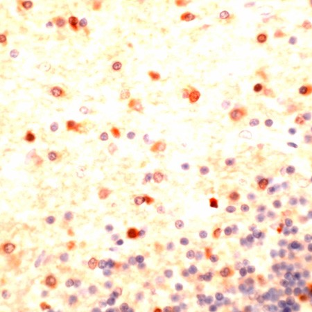 Human cerebellum stained with Anti-Sodium channel pan.