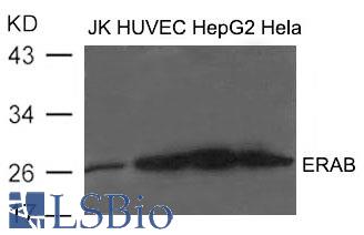 Western blot of extract from JK, HUVEC, HepG2 and HeLa cells using ERAB antibody