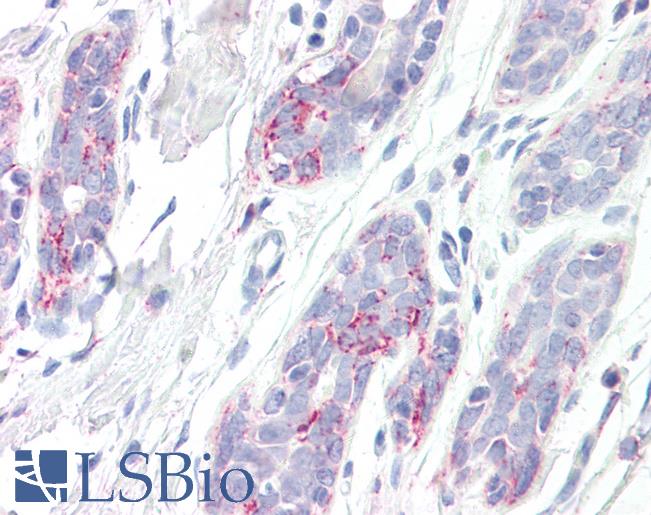 Anti-HSD17B10 / HADH2 antibody IHC staining of human breast. Immunohistochemistry of formalin-fixed, paraffin-embedded tissue after heat-induced antigen retrieval.