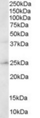 Staining (0.3 ug/ml) of Human Brain lysate (RIPA buffer, 30 ug total protein per lane). Primary incubated for 1 hour. Detected by chemiluminescence.