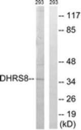 Western blot of extracts from 293 cells, using DHRS8 Antibody. The lane on the right is treated with the synthesized peptide.