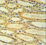 HSD17B11 Antibody IHC of formalin-fixed and paraffin-embedded lung tissue followed by peroxidase-conjugated secondary antibody and DAB staining.