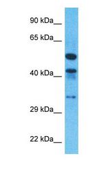 Western blot of DHB11 Antibody with human Fetal Liver lysate.