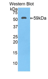Western blot of recombinant HSD17B12.