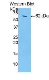 Western blot of recombinant HSD17B12.
