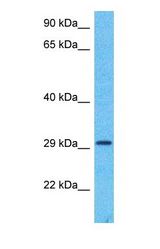 Western blot of DHB12 Antibody with human Fetal Liver lysate.