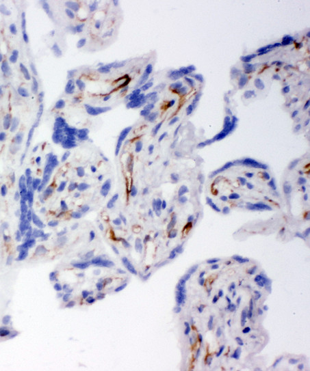 HSD17B2 antibody. IHC(F): Human Placenta Tissue.