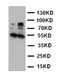 WB of HSD17B2 antibody. Lane 1: Human Placenta Tissue Lysate. Lane 2: Human Placenta Tissue Lysate.