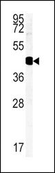Western blot of HSD17B2 Antibody in MDA-MB435 cell line lysates (35 ug/lane). HSD17B2 (arrow) was detected using the purified antibody.