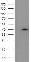 HEK293T cells were transfected with the pCMV6-ENTRY control (Left lane) or pCMV6-ENTRY HSD17B2 (Right lane) cDNA for 48 hrs and lysed. Equivalent amounts of cell lysates (5 ug per lane) were separated by SDS-PAGE and immunoblotted with anti-HSD17B2.