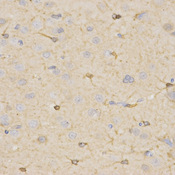 Immunohistochemistry of paraffin-embedded rat brain using HSD17B2 antibody at dilution of 1:200 (x400 lens).