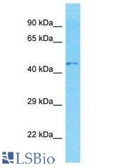 GPR142 antibody Western Blot of MDA-MB-435s. Antibody dilution: 1 ug/ml.