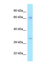 HSD17B3 antibody LS-C146038 Western blot of 721_B Cell lysate. Antibody concentration 1 ug/ml.