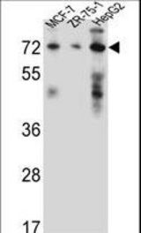 HSD17B4 Antibody western blot of MCF-7,ZR-75-1,HepG2 cell line lysates (35 ug/lane). The HSD17B4 antibody detected the HSD17B4 protein (arrow).