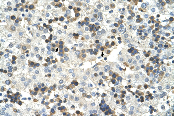 HSD17B6 antibody LS-C40332 IHC of formalin-fixed, paraffin-embedded human Liver. Positive label: Hematopoietic cells indicated with arrows. Antibody concentration 4-8 ug/ml. Magnification 400X.