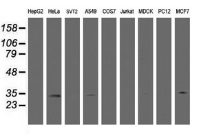Western blot of extracts (35ug) from 9 different cell lines by using anti-HSD17B8 monoclonal antibody (HepG2: human; HeLa: human; SVT2: mouse; A549: human; COS7: monkey; Jurkat: human; MDCK: canine; PC12: rat; MCF7: human).
