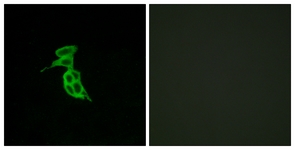 Immunofluorescence of LOVO cells, using GPR143 Antibody. The picture on the right is treated with the synthesized peptide.