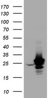HEK293T cells were transfected with the pCMV6-ENTRY control (Left lane) or pCMV6-ENTRY HSD17B8 (Right lane) cDNA for 48 hrs and lysed. Equivalent amounts of cell lysates (5 ug per lane) were separated by SDS-PAGE and immunoblotted with anti-HSD17B8.