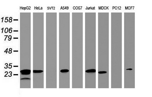 Western blot of extracts (35 ug) from 9 different cell lines by using anti-HSD17B8 monoclonal antibody (HepG2: human; HeLa: human; SVT2: mouse; A549: human; COS7: monkey; Jurkat: human; MDCK: canine; PC12: rat; MCF7: human).