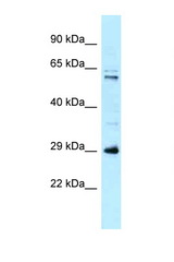 HSD17B8 antibody LS-C146002 Western blot of 8226 Cell lysate. Antibody concentration 1 ug/ml.